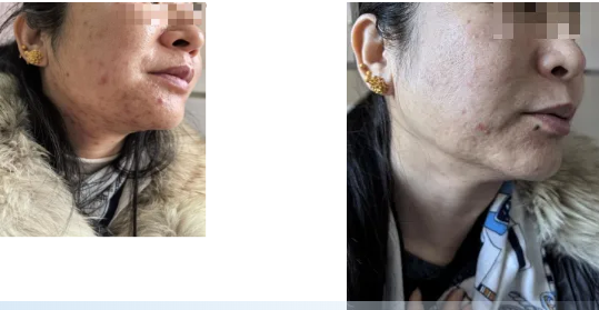 1775200821467630.png image.png