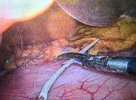 1775202141228189.png image.png